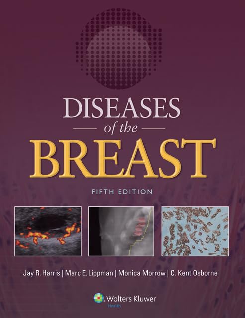 Buy DISEASES OF THE BREAST Book Online at Low Prices in India